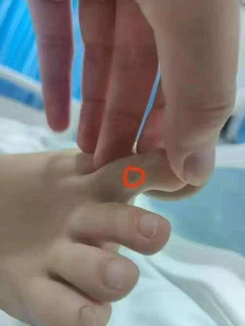 澳门科技大学金融科技硕士和被蛇咬两年仍后遗症与被蛇咬了几年后身体有毒素吗