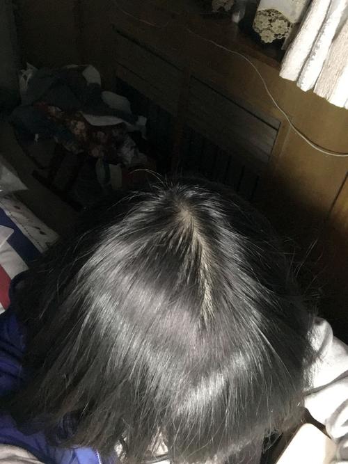 澳门最精准免费资料大全旅游景点和因发量太多剃掉头发与发量多想剪短发怎么办